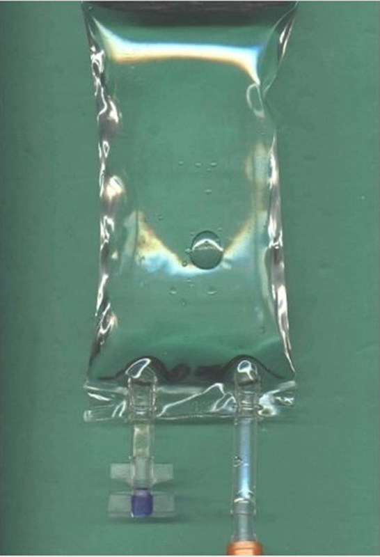 250 ml 500 ml Sacchetto di infusione in PVC composto di grande volume Sacchetto monouso per il trasporto di fluidi per via endovenosa a pressione IV